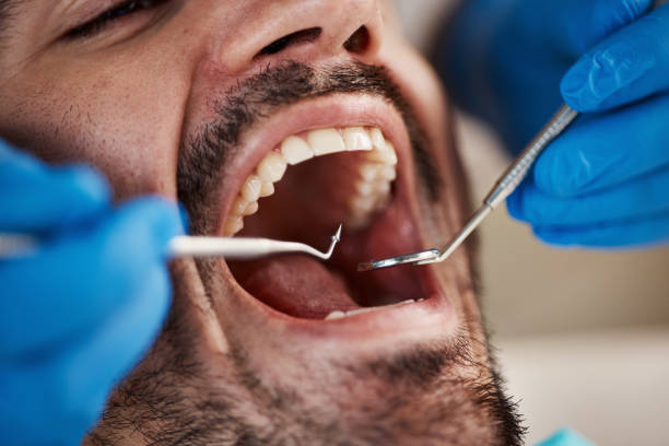 Best Broken or Chipped Tooth Repair in Fortuna, CA